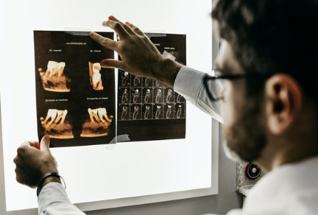 Picture of doctor or a healthcare provider who is observing the X-ray sheet of a patient so that he 